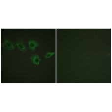 MYPT1 (Phospho-Thr696) Antibody