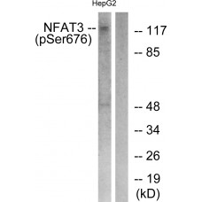 NFAT3 (Phospho-Ser676) Antibody