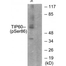 TIP60 (Phospho-Ser86) Antibody