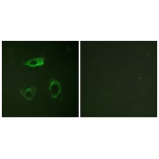 CD18/ITGB2 (Phospho-Thr758) Antibody