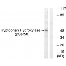 Tryptophan Hydroxylase (Phospho-Ser58) Antibody