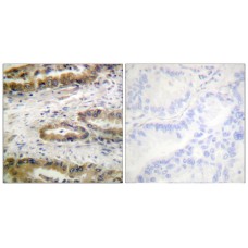VEGFR2 (Phospho-Tyr1054) Antibody