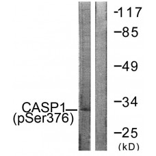 Caspase 1 (Phospho-Ser376) Antibody