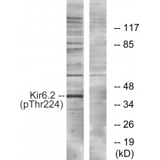Kir6.2 (Phospho-Thr224) Antibody