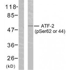 ATF2 (Phospho-Ser62 or 44) Antibody
