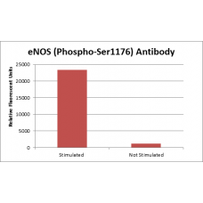 eNOS (Phospho-Ser1176) Fluorometric Cell-Based ELISA Kit