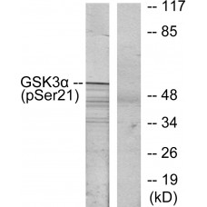 GSK3 alpha (Phospho-Ser21) Antibody