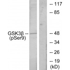 GSK3 beta (Phospho-Ser9) Antibody