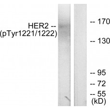 HER2 (Phospho-Tyr1221/Tyr1222) Antibody