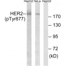 HER2 (Phospho-Tyr877) Antibody