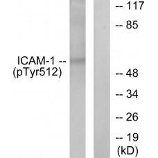 ICAM-1 (Phospho-Tyr512) Antibody