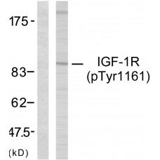 IGF1R (Phospho-Tyr1161) Antibody