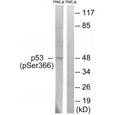 p53 (Phospho-Ser366) Antibody
