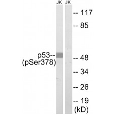 p53 (Phospho-Ser378) Antibody