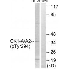 CK-1 alpha (Phospho-Tyr294) Antibody