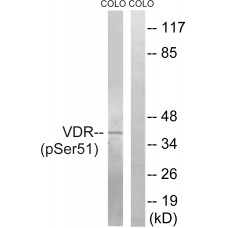 Vitamin D3 Receptor (Phospho-Ser51) Antibody
