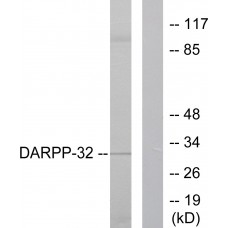 DARPP-32 Antibody