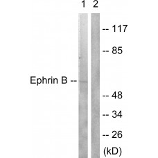 EFNB1/2 Antibody