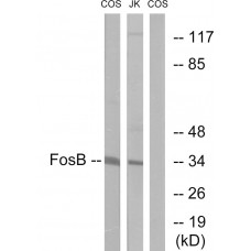 FosB Antibody