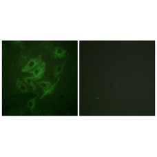 NMDAR2A/B Antibody