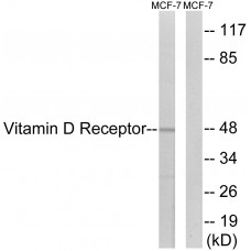 Vitamin D Receptor Antibody