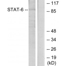 STAT6 Antibody