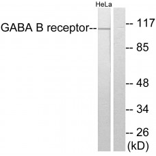 GABA-B Receptor Antibody