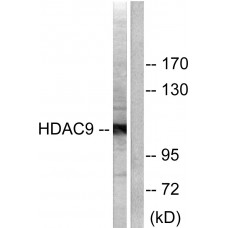 HDAC9 Antibody