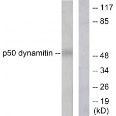 p50 Dynamitin Antibody