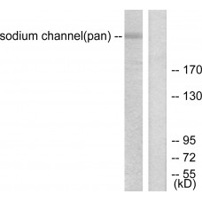Sodium Channel-pan Antibody