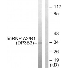 hnRNP A2/B1 Antibody