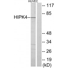 HIPK4 Antibody