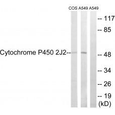 Cytochrome P450 2J2 Antibody