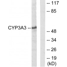 Cytochrome P450 3A4/5 Antibody