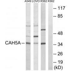 CA5A Antibody