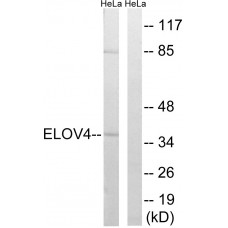 ELOVL4 Antibody