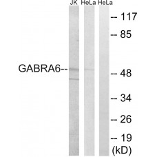 GABRA6 Antibody