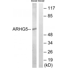 ARHGEF5 Antibody