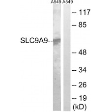 SLC9A9 Antibody