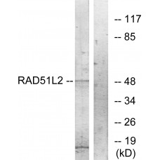 RAD51L2 Antibody