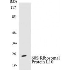 60S Ribosomal Protein L10 Colorimetric Cell-Based ELISA Kit