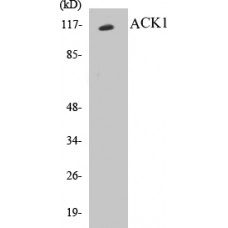 ACK1 Colorimetric Cell-Based ELISA Kit