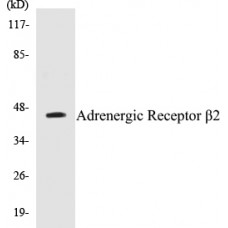 Adrenergic Receptor beta2 Colorimetric Cell-Based ELISA Kit