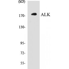 ALK Colorimetric Cell-Based ELISA Kit