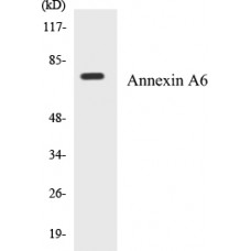 Annexin A6 Colorimetric Cell-Based ELISA Kit