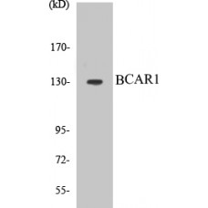 BCAR1 Colorimetric Cell-Based ELISA Kit