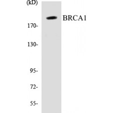 BRCA1 Colorimetric Cell-Based ELISA Kit