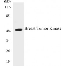 Breast Tumor Kinase Colorimetric Cell-Based ELISA Kit