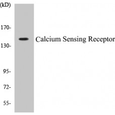 Calcium Sensing Receptor Colorimetric Cell-Based ELISA Kit