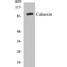 Calnexin Colorimetric Cell-Based ELISA Kit